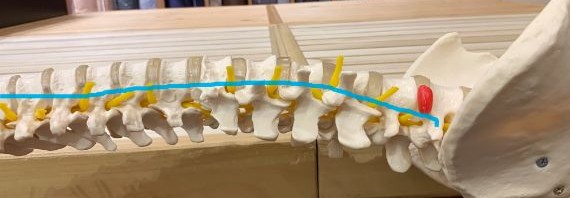 E様が20年使用したマットレスの腰椎の角度のイメージ