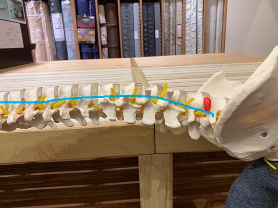 E様が20年使用したマットレスの腰椎の角度のイメージ