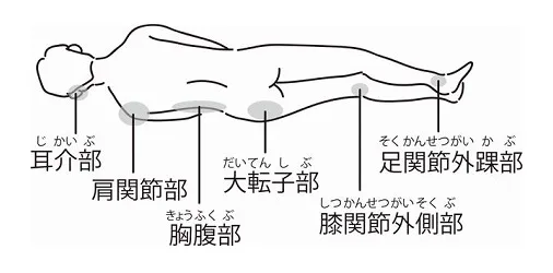 1、床ずれ(褥瘡)の方、あるいはなりそうな方